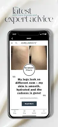 Ameliorate screenshot 1